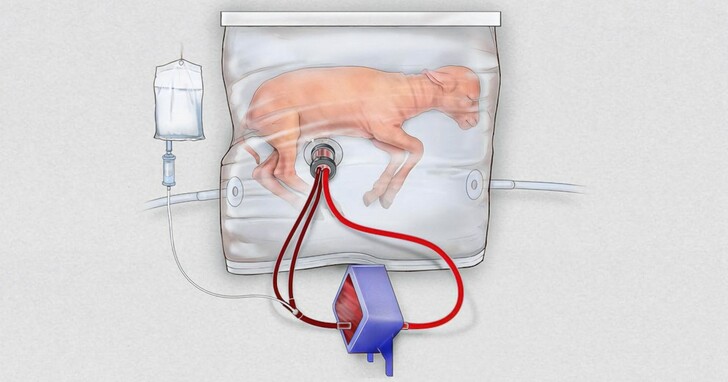 研究人員開發「人造子宮」將永遠改變生殖分娩的過程