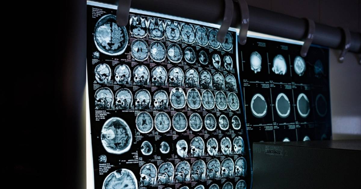 AI 急診室大逆襲！哈佛研究：診斷準確率高於人類醫生