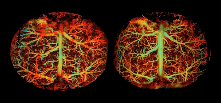 小鼠大腦血流的視圖（左）以及使用 AI 工具提高圖像品質和準確性後得到的相同視圖。圖片來源：杜克大