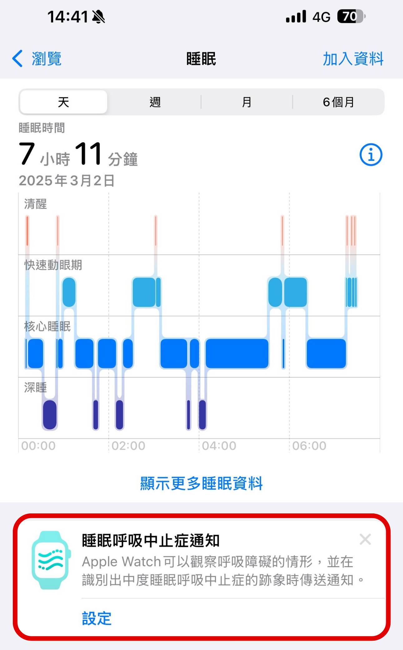 如何啟用 Apple Watch 的睡眠呼吸中止症偵測功能？